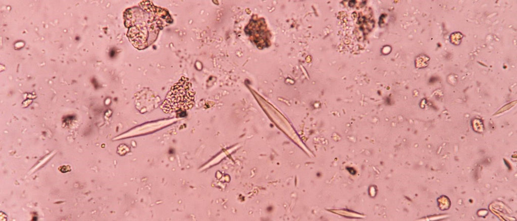 glutathione bad side effects Could I Have Gut Parasites? Symptoms, Types, & More