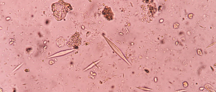 Blog of Gut Parasites: Types, Symptoms, and More which have image parasites under microscope