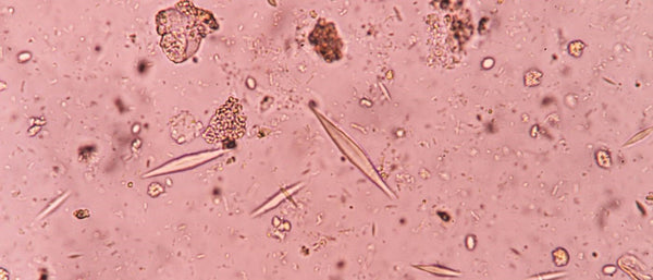 parasites under microscope