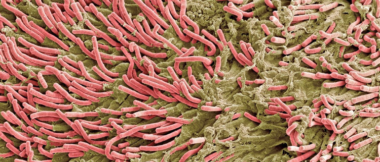 Blog of Biofilm Disruptors: What They Are and Why We Need Them for Optimal Detox which have image microscopic biofilms