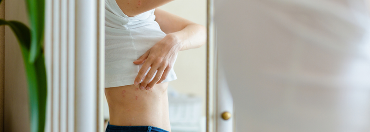 Blog of EPO and Skin Health: What GLA Means for Your Skin Barrier which have image EPO and Skin Health: What GLA Means for Your Skin Barrier